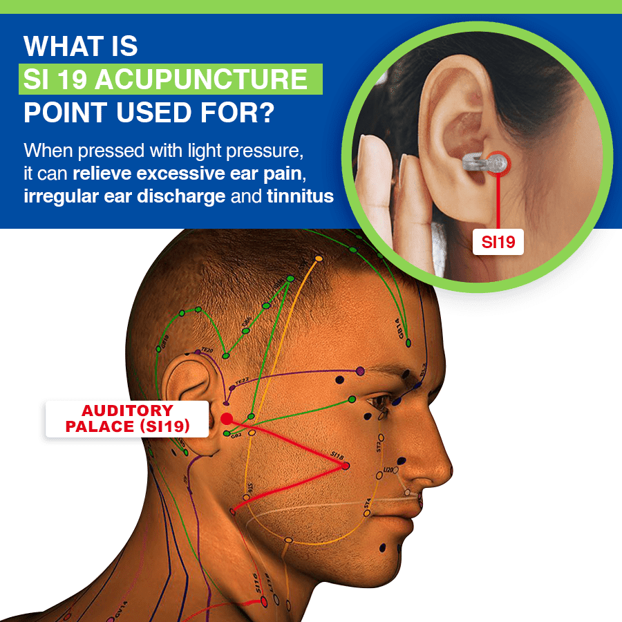 *LUHAKA™ - AcuPeace Tinnitus Relief Device*